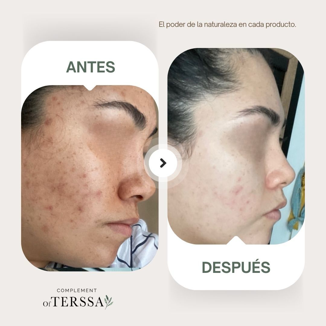 Crema Facial Terssa