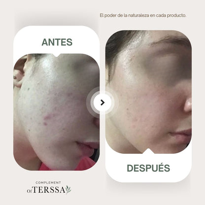 Gel Limpiador Facial Terssa
