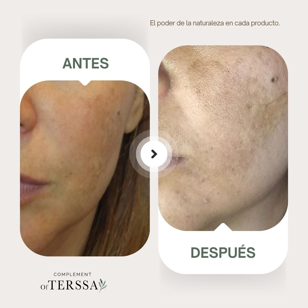 Gel Limpiador Facial Terssa
