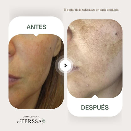 Gel Limpiador Facial Terssa
