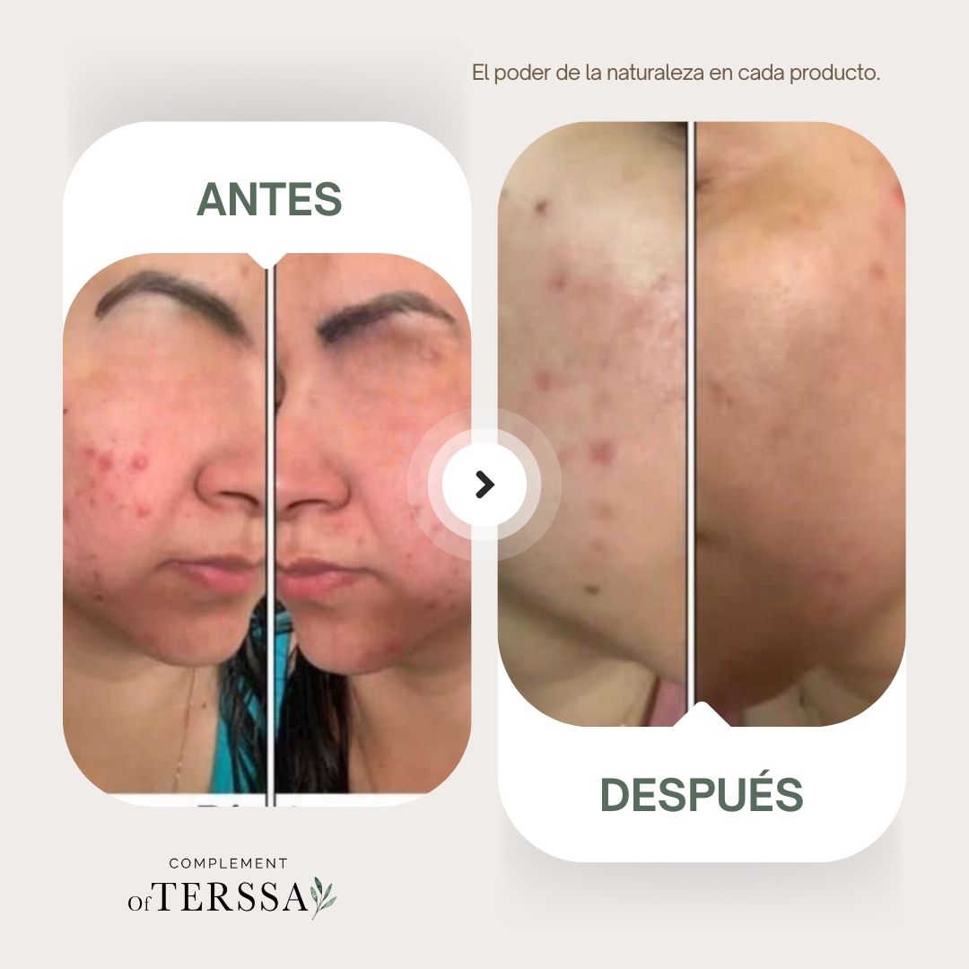Gel Limpiador Facial Terssa