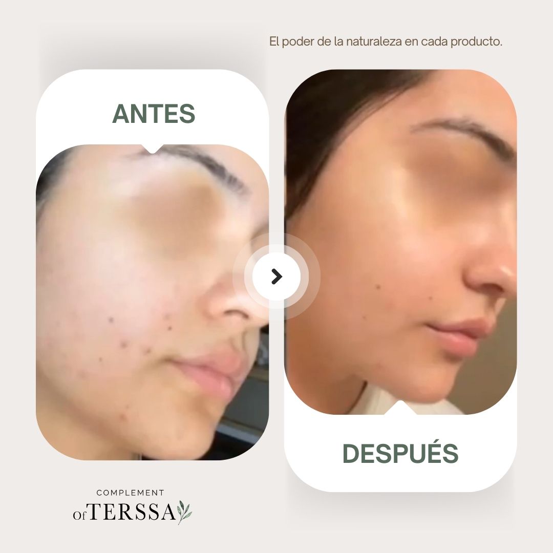 Gel Limpiador Facial Terssa