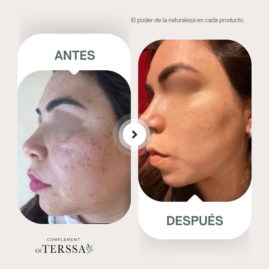 Gel Limpiador Facial Terssa