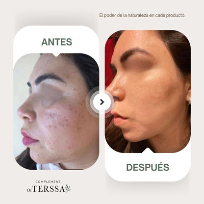 Gel Limpiador Facial Terssa